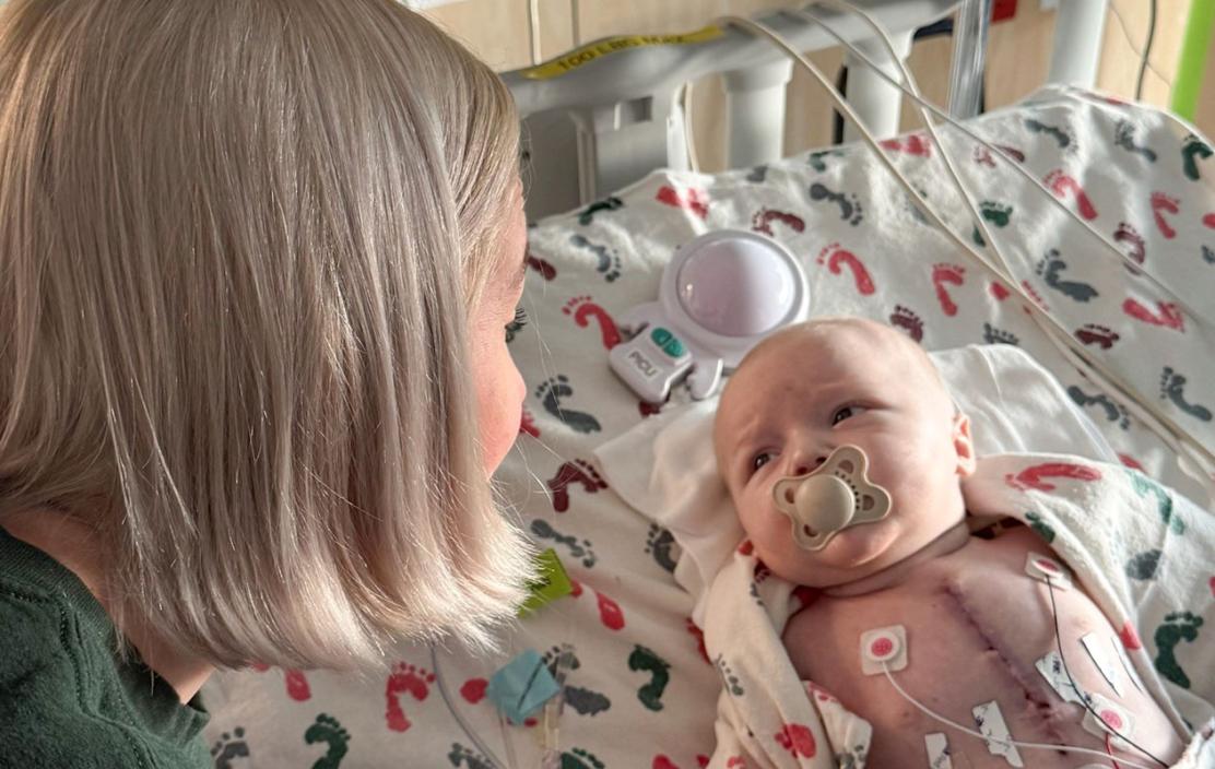 A mother looks at her small baby lying in a hospital bed. The baby is using a pacifier and is hooked up to various monitoring devices. The baby is recovering from heart surgery.