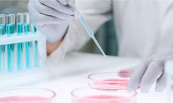 A laboratory technician holds a petri dish and performs a diagnostic test
